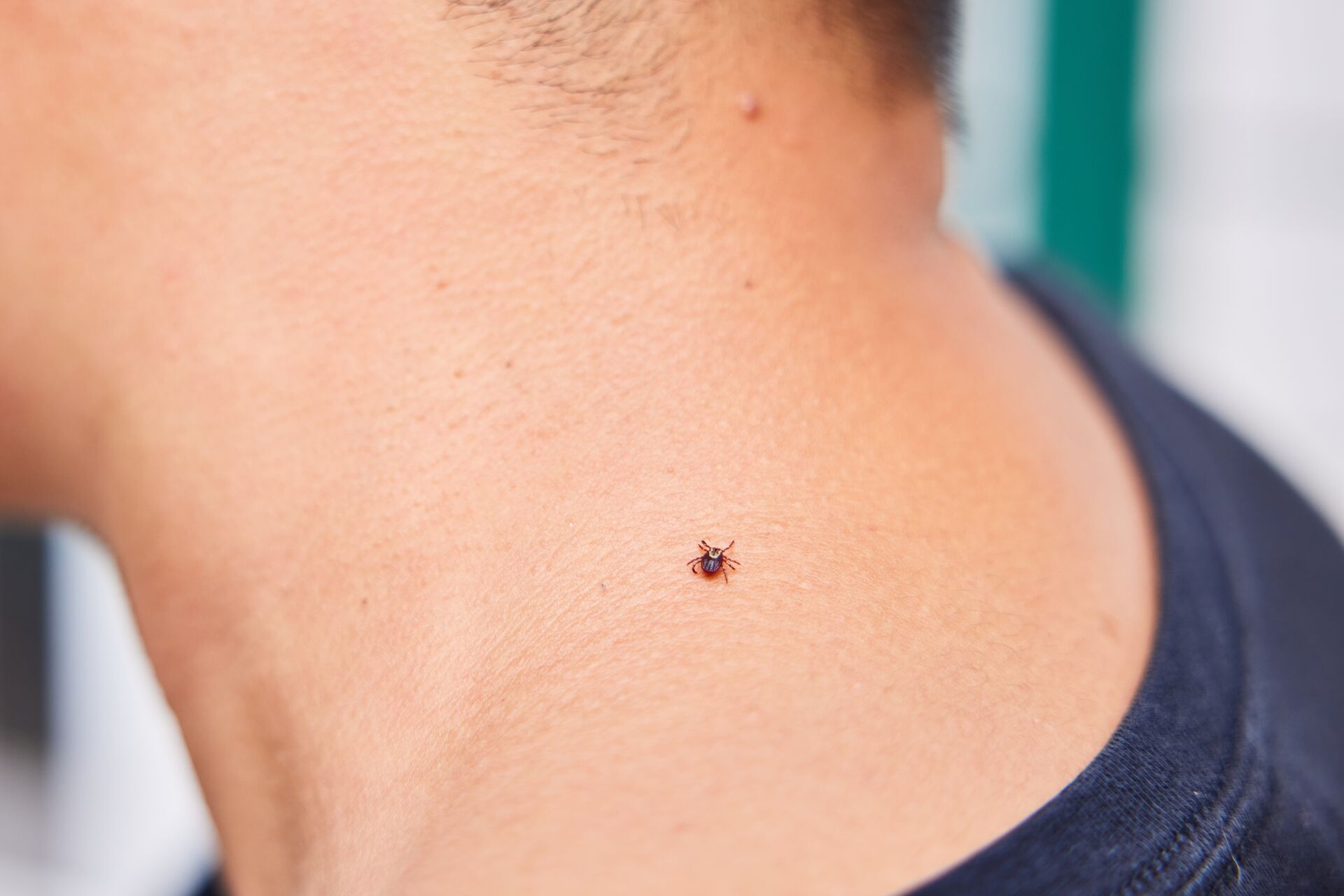 A tick on a hunter's neck, how to combat ticks concept.